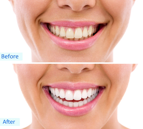 Sexy Sparkles Tooth Whitener, Teeth Whitening Activated Charcoal Powder Natural Organic Whitens Stained Teeth